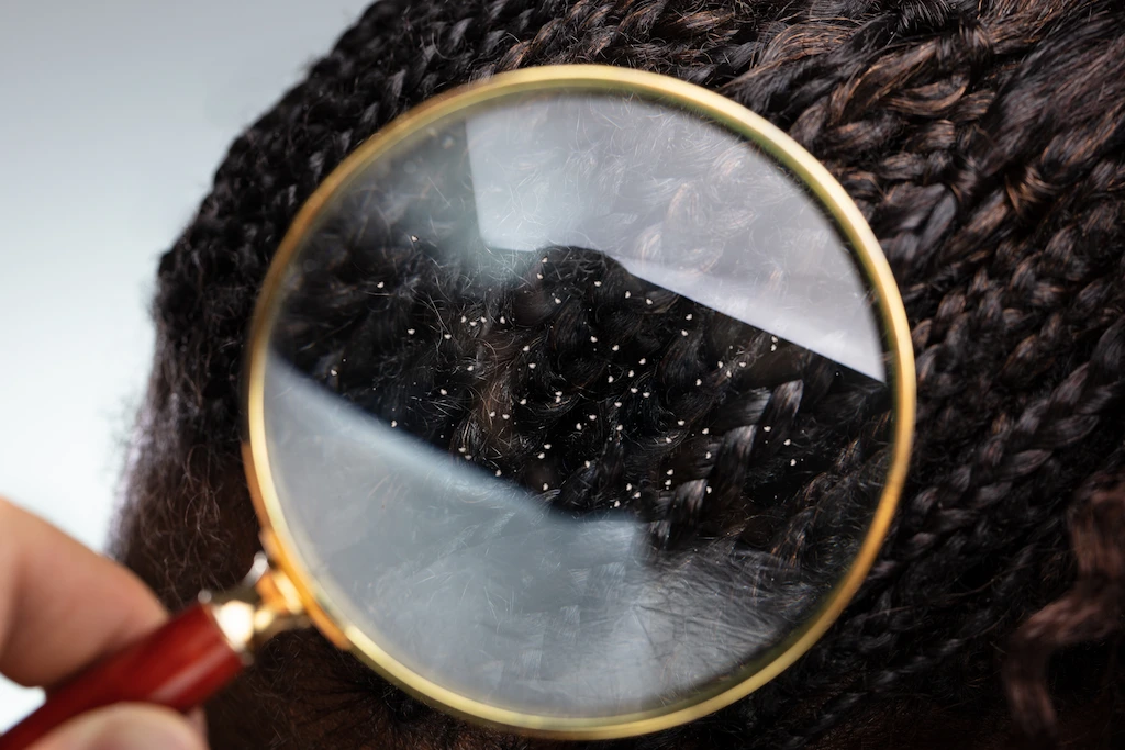 Lice Life Cycle How Long Do Head Lice Live? LiceDoctors